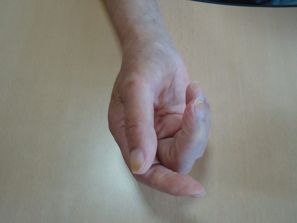 86歳男性